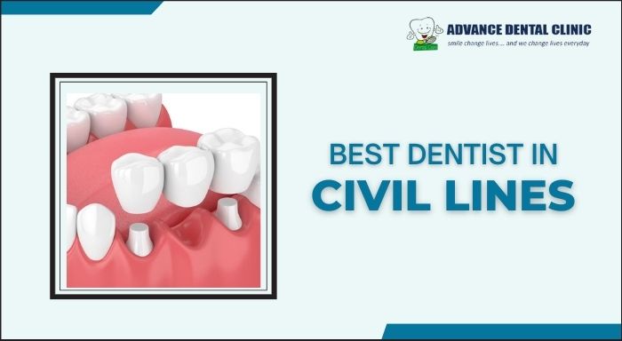 Best Dentist in Civil Lines
