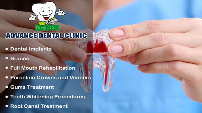 Dental Hospital in GTB Nagar