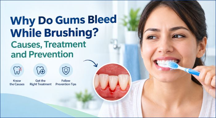 Why Do Gums Bleed While Brushing