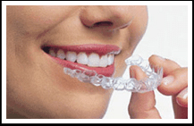 Invisalign