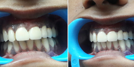 Dentist in Vijay Nagar