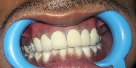 Best Dental Clinic in Mukherjee Nagar