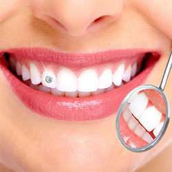 Tooth Jewellery